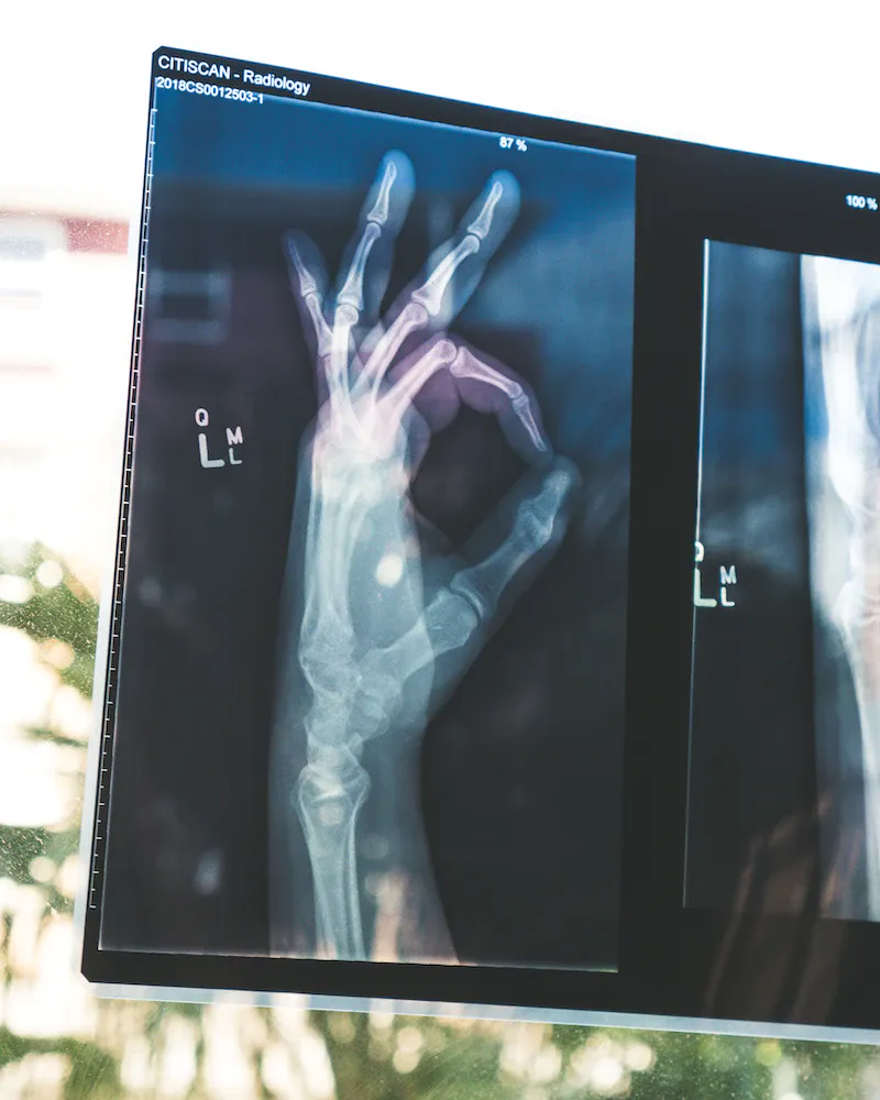 Learn about the challenges and solutions related to handling medical data, including the use of GPUs and touch devices for virtual autopsies, in this informative blog post. /future-of-medical-technology-from-virtual-autopsies-to-functional-mri/future-of-medical-technology-from-virtual-autopsies-to-functional-mri.webp